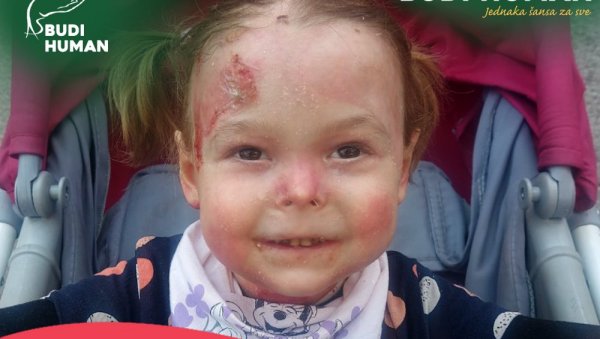 НАЂА (4), ДЕТЕ ЛЕПТИР, О ТРОШКУ ДРЖАВЕ ДОБИЈА ЛЕК: Одобрена терапија која кошта 630.000 долара годишње НАЂА (4), ДЕТЕ ЛЕПТИР, О ТРОШКУ ДРЖАВЕ ДОБИЈА ЛЕК: Одобрена терапија која кошта 630.000 долара годишње
