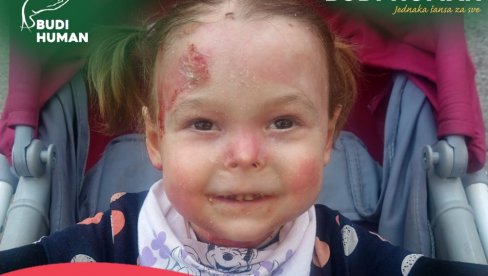 NAĐA (4), DETE LEPTIR, O TROŠKU DRŽAVE DOBIJA LEK: Odobrena terapija koja košta 630.000 dolara godišnje NAĐA (4), DETE LEPTIR, O TROŠKU DRŽAVE DOBIJA LEK: Odobrena terapija koja košta 630.000 dolara godišnje