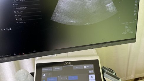 PREVENTIVNI PREGLEDI: Muškarci i žene zainteresovani za preventivu PREVENTIVNI PREGLEDI: Muškarci i žene zainteresovani za preventivu