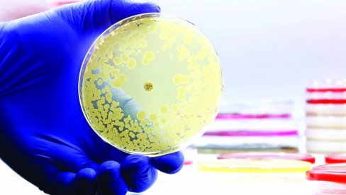 STREPTOKOKNI SINDROM HARA JAPANOM: Retka i opasna bakterijska infekcija širi se rekordnom brzinom STREPTOKOKNI SINDROM HARA JAPANOM: Retka i opasna bakterijska infekcija širi se rekordnom brzinom