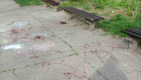 POVREĐEN ŠESNAESTOGODIŠNJAK, ZAVRŠIO NA HIRURGIJI: Incident na novosadskom Limanu, maloletnik pretučen? POVREĐEN ŠESNAESTOGODIŠNJAK, ZAVRŠIO NA HIRURGIJI: Incident na novosadskom Limanu, maloletnik pretučen?