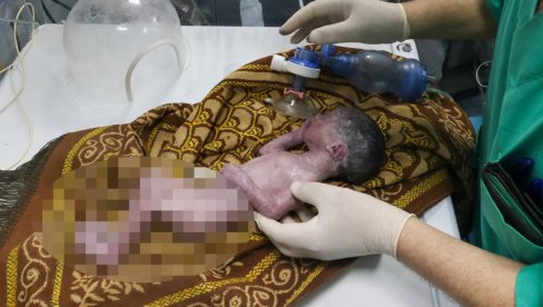 BEBA BILA NESTRPLJIVA DA UGLEDA SVET: Ekipa Hitne pomoći porodila ženu na putu do bolnice BEBA BILA NESTRPLJIVA DA UGLEDA SVET: Ekipa Hitne pomoći porodila ženu na putu do bolnice