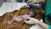 БЕБА БИЛА НЕСТРПЉИВА ДА УГЛЕДА СВЕТ: Екипа Хитне помоћи породила жену на путу до болнице БЕБА БИЛА НЕСТРПЉИВА ДА УГЛЕДА СВЕТ: Екипа Хитне помоћи породила жену на путу до болнице