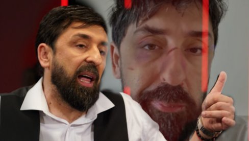SAV U MODRICAMA I OGREBOTINAMA: Šta se desilo Ognjenu Amidžiću? (FOTO) SAV U MODRICAMA I OGREBOTINAMA: Šta se desilo Ognjenu Amidžiću? (FOTO)