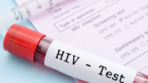 UDVOSTRUČEN BROJ ZARAŽENIH HIV-om: Za manje od godinu dana zabeležen je porast obolelih od ove bolesti na KiM UDVOSTRUČEN BROJ ZARAŽENIH HIV-om: Za manje od godinu dana zabeležen je porast obolelih od ove bolesti na KiM