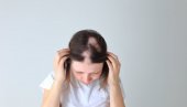MUČI VAS OPADANJE KOSE: Oprez ako imate alopeciju, ona je odraz i vašeg zdravlja MUČI VAS OPADANJE KOSE: Oprez ako imate alopeciju, ona je odraz i vašeg zdravlja