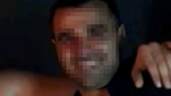 ПЛАШИМ СЕ ЗА СВОЈ ЖИВОТ: Огласила се девојка која је претучена у новобеоградском ресторану ПЛАШИМ СЕ ЗА СВОЈ ЖИВОТ: Огласила се девојка која је претучена у новобеоградском ресторану