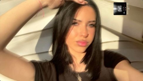 DOBILA GUŠENJE, INFEKCIJA SE SPUSTILA NA SRCE I PLUĆA: Novi detalji o smrti DŽejle (16) nakon vađenja zuba DOBILA GUŠENJE, INFEKCIJA SE SPUSTILA NA SRCE I PLUĆA: Novi detalji o smrti DŽejle (16) nakon vađenja zuba