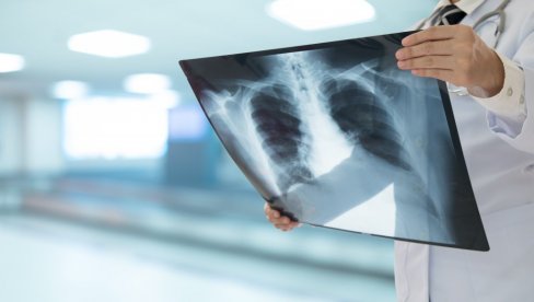 ŠTA JE PNEUMONIJA, KOJI SU NAJČEŠĆI SIMPTOMI I KAKO JE LEČITI?: Sve o uzrocima i opasnostima upale pluća ŠTA JE PNEUMONIJA, KOJI SU NAJČEŠĆI SIMPTOMI I KAKO JE LEČITI?: Sve o uzrocima i opasnostima upale pluća