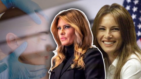 ISPLIVALA SLIKA IZ MLADOSTI: Melanija ipak nije prirodna lepotica? Negira estetske korekcije, a evo šta kaže poznati hirurg (FOTO) ISPLIVALA SLIKA IZ MLADOSTI: Melanija ipak nije prirodna lepotica? Negira estetske korekcije, a evo šta kaže poznati hirurg (FOTO)
