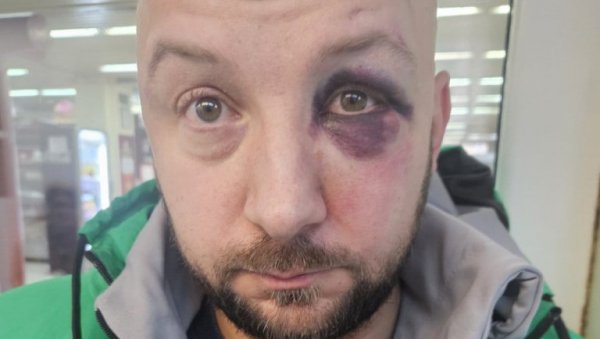 НАПАДНУТ ФУНКЦИОНЕР СНС: Ескалација насиља опозиције у Краљеву НАПАДНУТ ФУНКЦИОНЕР СНС: Ескалација насиља опозиције у Краљеву