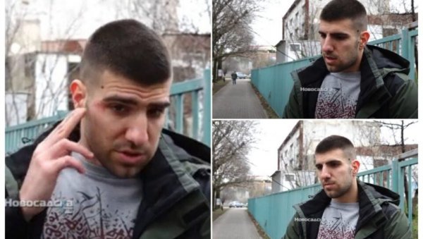 (УЗНЕМИРУЈУЋИ ФОТО) Претучен политички аналитичар Вукашин Ђоковић, па послао снажну поруку: Војводина је Србија (УЗНЕМИРУЈУЋИ ФОТО) Претучен политички аналитичар Вукашин Ђоковић, па послао снажну поруку: Војводина је Србија
