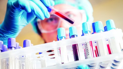 OTKRIVA KARCINOM NA VREME: Uz test krvi, rak pankreasa može da se kvalitetnije leči OTKRIVA KARCINOM NA VREME: Uz test krvi, rak pankreasa može da se kvalitetnije leči