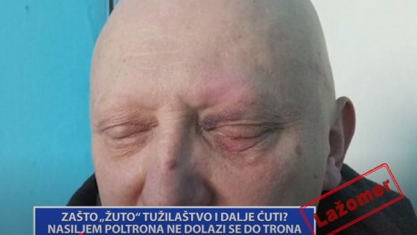 НАСИЉЕМ ПОЛТРОНА НЕ ДОЛАЗИ СЕ ДО ТРОНА (ВИДЕО) НАСИЉЕМ ПОЛТРОНА НЕ ДОЛАЗИ СЕ ДО ТРОНА (ВИДЕО)