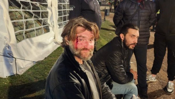 ГРАЂАНИ БРУТАЛНО НАПАДНУТИ КОД ПИОНИРСКОГ ПАРКА: Једном сломљена аркада, другог шутирали и гађали колачима (ФОТО) ГРАЂАНИ БРУТАЛНО НАПАДНУТИ КОД ПИОНИРСКОГ ПАРКА: Једном сломљена аркада, другог шутирали и гађали колачима (ФОТО)