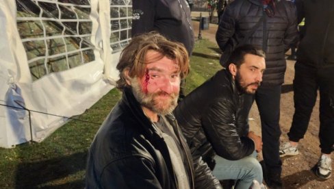 GRAĐANI BRUTALNO NAPADNUTI KOD PIONIRSKOG PARKA: Jednom slomljena arkada, drugog šutirali i gađali kolačima (FOTO) GRAĐANI BRUTALNO NAPADNUTI KOD PIONIRSKOG PARKA: Jednom slomljena arkada, drugog šutirali i gađali kolačima (FOTO)