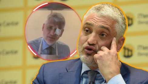 ČEDA PONOVO POVREĐEN Ovaj put stradalo oko: Sve mora da se plati (VIDEO) ČEDA PONOVO POVREĐEN Ovaj put stradalo oko: Sve mora da se plati (VIDEO)