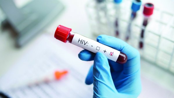 МАЊЕ НОВЦА, ВИШЕ ЗАРАЖЕНИХ ХИВ-ОМ: Упозорење истраживача после најновије, забрињавајуће студије МАЊЕ НОВЦА, ВИШЕ ЗАРАЖЕНИХ ХИВ-ОМ: Упозорење истраживача после најновије, забрињавајуће студије