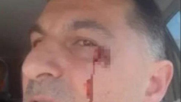 ДРАМА У ЦРВЕНКИ: Блокадери претукли човека насред улице- разбијена му аркада! (ВИДЕО)