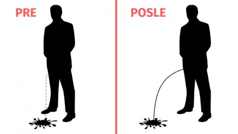 MUŠKARCIMA POSLE PEDESETE MLAZ URINA PRIMETNO SLABI