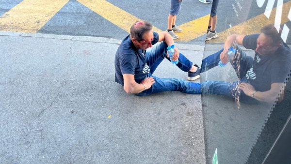 ЈЕЗИВЕ СЦЕНЕ Блокадери пролили крв - брутално насиље (ВИДЕО) ЈЕЗИВЕ СЦЕНЕ Блокадери пролили крв - брутално насиље (ВИДЕО)