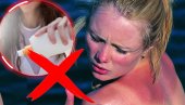 Жени (48) ПУКЛА КОСТ због креме за сунчање! Ово је УПОЗОРЕЊЕ за све