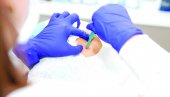 REZULTATI ZA SAMO 20 MINUTA: Biopsija tumora pomoću nano-igličnog flastera