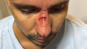 JEZIVO NASILJE BLOKADERA: Pogodili mladića kamenicom u glavu! (FOTO)