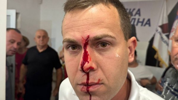 БЛОКАДЕРИ ЧОВЕКУ РАСКРВАРИЛИ ГЛАВУ: Језиво насиље у Лазаревцу (ФОТО) БЛОКАДЕРИ ЧОВЕКУ РАСКРВАРИЛИ ГЛАВУ: Језиво насиље у Лазаревцу (ФОТО)