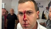 BLOKADERI ČOVEKU RASKRVARILI GLAVU: Jezivo nasilje u Lazarevcu (FOTO) BLOKADERI ČOVEKU RASKRVARILI GLAVU: Jezivo nasilje u Lazarevcu (FOTO)