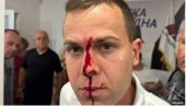 ПОВРЕЂЕНА ТРИ ЧЛАНА СНС: Огласио се Општински одбор у Лазаревцу поводом језивог насиља блокадера