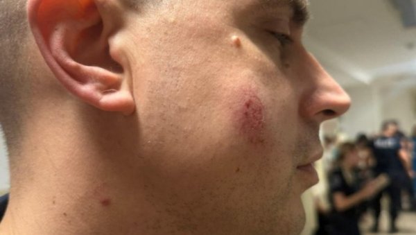 РАСТЕ БРОЈ ПОВРЕЂЕНИХ ПОЛИЦАЈЦА У ПАНЧЕВУ! Један гађан каменом у главу - језиво (ФОТО)
