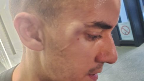 UHAPŠEN NAPADAČ NA EKIPU INFORMERA: Brutalno napao novinara i kamermana