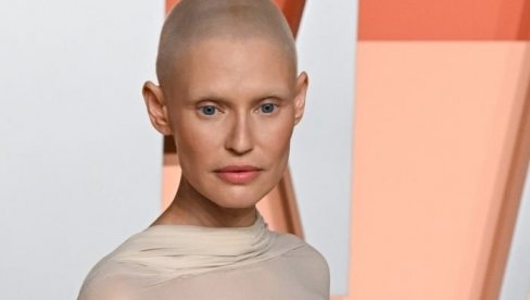 LEPOTICA SE BORILA SE SA RAKOM, VICTORIAS SECRET JE ODBILA ZA REVIJU, A ONDA IH JE JAVNO POSRAMILA PISMOM: Nisam najmlađa, nemam najlepše LEPOTICA SE BORILA SE SA RAKOM, VICTORIAS SECRET JE ODBILA ZA REVIJU, A ONDA IH JE JAVNO POSRAMILA PISMOM: Nisam najmlađa, nemam najlepše
