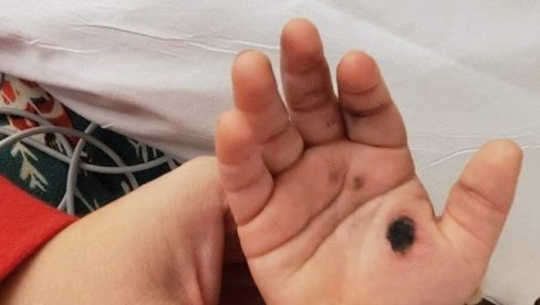 BEBA ZAMALO NASTRADALA ZBOG PUNJAČA ZA TELEFON: Majka poslala upozorenje roditeljima BEBA ZAMALO NASTRADALA ZBOG PUNJAČA ZA TELEFON: Majka poslala upozorenje roditeljima