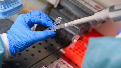 ОДОБРЕНА ВАКЦИНА ЗА ЧЕЧЕЊЕ МЕЛАНОМА: Министарство здравља Русије донело одлуку