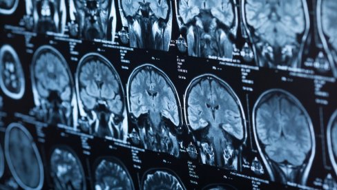 СРПСКИ АС ДОЖИВЕО ПОТРЕС МОЗГА! Ни тренер не зна када ће моћи на терен