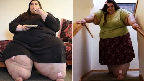 IMALA SKORO 300 KG, NIJE MOGLA DA HODA: Danas igleda sjajno - a na intenetu je prati više od 400 hiljada ljudi! (FOTO)