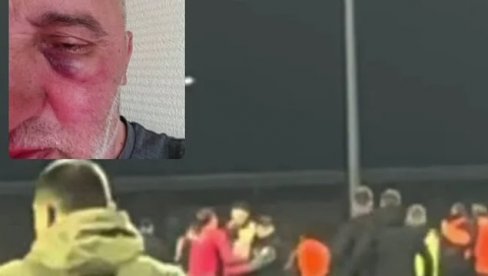 SKANDAL TRESE REGION! Fudbaleri Željezničara brutalno pretukli fotografa Sloge