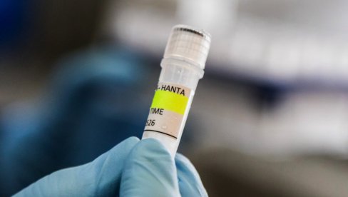 RUSKI EPIDEMIOLOG: Vakcina protiv hantavirusa moguća, ali registracija traje nekoliko godina