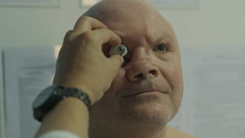 VEŠTAČKE OČI, RUKE, NOGE: Prizori ukrajinskih ranjenika iz vojnih bolnica ravni jamama pakla (VIDEO)