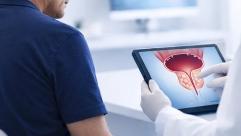 ZNACI KOJI UPOZORAVAJU NA PROBLEME SA PROSTATOM